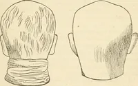 An illustration from Lectures on phrenology, including its application to the present and prospective condition of the United States (1840)