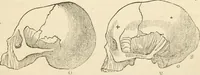 An illustration from Lectures on phrenology, including its application to the present and prospective condition of the United States (1840)