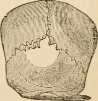 An illustration from Lectures on phrenology, including its application to the present and prospective condition of the United States (1840)