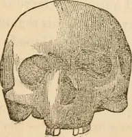 An illustration from Lectures on phrenology, including its application to the present and prospective condition of the United States (1840)
