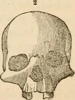 An illustration from Lectures on phrenology, including its application to the present and prospective condition of the United States (1840)