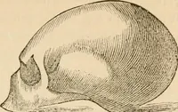 An illustration from Lectures on phrenology, including its application to the present and prospective condition of the United States (1840)