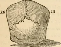 An illustration from Lectures on phrenology, including its application to the present and prospective condition of the United States (1840)