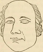 Picture 26 of 30 from Lectures on phrenology, including its application to the present and prospective condition of the United States (1840), leaf 260
