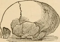 An illustration from Lectures on phrenology, including its application to the present and prospective condition of the United States (1840)