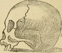 An illustration from Lectures on phrenology, including its application to the present and prospective condition of the United States (1840)