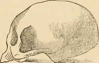 An illustration from Lectures on phrenology, including its application to the present and prospective condition of the United States (1840)