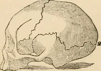 An illustration from Lectures on phrenology, including its application to the present and prospective condition of the United States (1840)