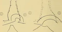 An illustration from Lehrbuch der Krankheiten des Herzens und der Blutgefässe (1906)
