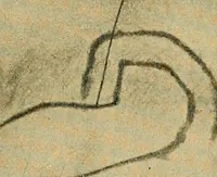 An illustration from Lehrbuch der Krankheiten des Herzens und der Blutgefässe (1906)