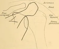 An illustration from Leitfaden des Röntgen-Verfahrens (1903)