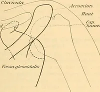 An illustration from Leitfaden des Röntgen-Verfahrens (1903)