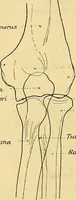An illustration from Leitfaden des Röntgen-Verfahrens (1903)