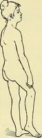 An illustration from Leçons cliniques de chirurgie infantile : deuxième série (1905)