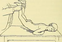 An illustration from Leçons cliniques de chirurgie infantile : deuxième série (1905)