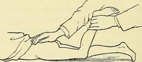An illustration from Leçons cliniques de chirurgie infantile : deuxième série (1905)