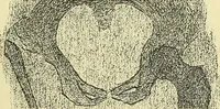An illustration from Leçons cliniques de chirurgie infantile : deuxième série (1905)