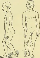 An illustration from Leçons cliniques de chirurgie infantile : deuxième série (1905)