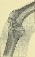 An illustration from Leçons cliniques de chirurgie infantile : deuxième série (1905)
