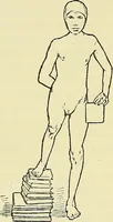 An illustration from Leçons cliniques de chirurgie infantile : deuxième série (1905)