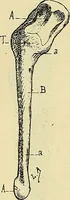 An illustration from Leçons cliniques de chirurgie infantile : deuxième série (1905)