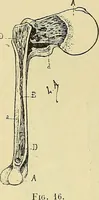 An illustration from Leçons cliniques de chirurgie infantile : deuxième série (1905)