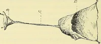 An illustration from Leçons cliniques de chirurgie infantile : deuxième série (1905)
