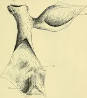 Picture 40 of 62 from Leçons cliniques de chirurgie infantile : deuxième série (1905), leaf 392