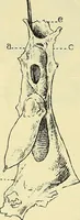 An illustration from Leçons cliniques de chirurgie infantile : deuxième série (1905)