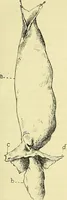 An illustration from Leçons cliniques de chirurgie infantile : deuxième série (1905)