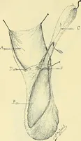 An illustration from Leçons cliniques de chirurgie infantile : deuxième série (1905)