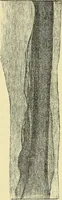 An illustration from Leçons cliniques de chirurgie infantile : deuxième série (1905)