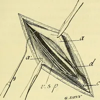 An illustration from Leçons cliniques de chirurgie infantile : deuxième série (1905)