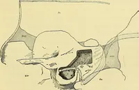 An illustration from Leçons cliniques de chirurgie infantile : deuxième série (1905)
