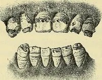 An illustration from Leçons cliniques de chirurgie infantile : deuxième série (1905)