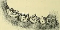 An illustration from Leçons cliniques de chirurgie infantile : deuxième série (1905)