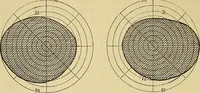 An illustration from Leçons cliniques sur l'hystérie et l'hypnotisme : faites à l'Hôpital Saint-André de Bordeaux (1891)
