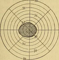 An illustration from Leçons cliniques sur l'hystérie et l'hypnotisme : faites à l'Hôpital Saint-André de Bordeaux (1891)