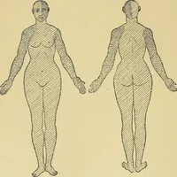 An illustration from Leçons cliniques sur l'hystérie et l'hypnotisme : faites à l'Hôpital Saint-André de Bordeaux (1891)