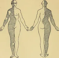 An illustration from Leçons cliniques sur l'hystérie et l'hypnotisme : faites à l'Hôpital Saint-André de Bordeaux (1891)