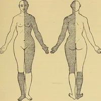 Picture 11 of 85 from Leçons cliniques sur l'hystérie et l'hypnotisme : faites à l'Hôpital Saint-André de Bordeaux (1891), leaf 150