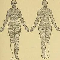 An illustration from Leçons cliniques sur l'hystérie et l'hypnotisme : faites à l'Hôpital Saint-André de Bordeaux (1891)