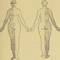 Picture 17 of 85 from Leçons cliniques sur l'hystérie et l'hypnotisme : faites à l'Hôpital Saint-André de Bordeaux (1891), leaf 218