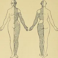 Picture 18 of 85 from Leçons cliniques sur l'hystérie et l'hypnotisme : faites à l'Hôpital Saint-André de Bordeaux (1891), leaf 221