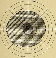 Picture 19 of 85 from Leçons cliniques sur l'hystérie et l'hypnotisme : faites à l'Hôpital Saint-André de Bordeaux (1891), leaf 222