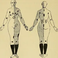 Picture 27 of 85 from Leçons cliniques sur l'hystérie et l'hypnotisme : faites à l'Hôpital Saint-André de Bordeaux (1891), leaf 267