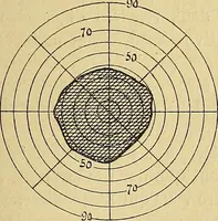 Picture 30 of 85 from Leçons cliniques sur l'hystérie et l'hypnotisme : faites à l'Hôpital Saint-André de Bordeaux (1891), leaf 308