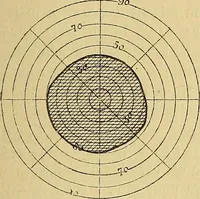 An illustration from Leçons cliniques sur l'hystérie et l'hypnotisme : faites à l'Hôpital Saint-André de Bordeaux (1891)