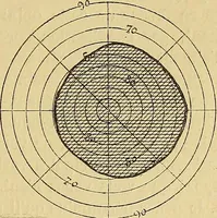 Picture 35 of 85 from Leçons cliniques sur l'hystérie et l'hypnotisme : faites à l'Hôpital Saint-André de Bordeaux (1891), leaf 322