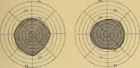 Picture 39 of 85 from Leçons cliniques sur l'hystérie et l'hypnotisme : faites à l'Hôpital Saint-André de Bordeaux (1891), leaf 336